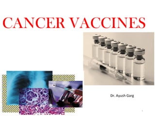 Dr. Ayush Garg
1
CANCER VACCINES
 