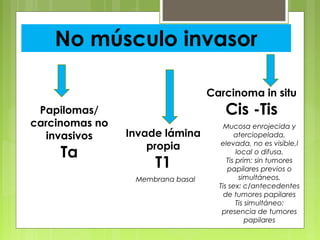 No músculo invasor
Papilomas/
carcinomas no
invasivos
Ta
Invade lámina
propia
T1
Carcinoma in situ
Cis -Tis
Membrana basal
Mucosa enrojecida y
aterciopelada,
elevada, no es visible,l
local o difusa.
Tis prim: sin tumores
papilares previos o
simultáneos.
Tis sex: c/antecedentes
de tumores papilares
Tis simultáneo:
presencia de tumores
papilares
 