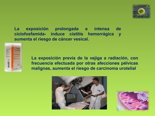 La exposición prolongada e intensa de
ciclofosfamida- induce cistitis hemorrágica y
aumenta el riesgo de cáncer vesical.
La exposición previa de la vejiga a radiación, con
frecuencia efectuada por otras afecciones pélvicas
malignas, aumenta el riesgo de carcinoma urotelial
 