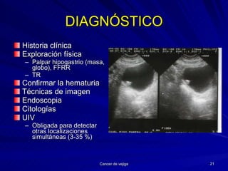 DIAGNÓSTICO Historia clínica Exploración física Palpar hipogastrio (masa, globo), FFRR TR Confirmar la hematuria Técnicas de imagen Endoscopia Citologías UIV Obligada para detectar otras localizaciones simultáneas (3-35 %) 