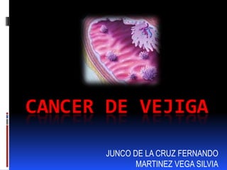 CANCER DE VEJIGA

       JUNCO DE LA CRUZ FERNANDO
              MARTINEZ VEGA SILVIA
 