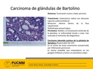 Otros adenocarcinomas
• Suelen aparecer en la glándula de bartolino o asociado a la enfermedad de paget.
Carcinoma adenoes...