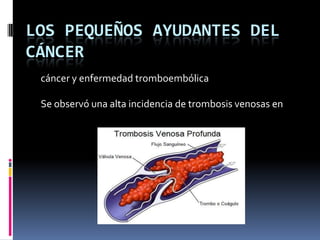 LOS PEQUEÑOS AYUDANTES DEL
CÁNCER
 cáncer y enfermedad tromboembólica

 Se observó una alta incidencia de trombosis venosas en
 