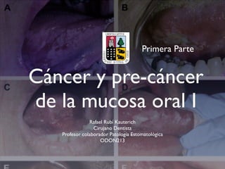 Primera Parte


Cáncer y pre-cáncer
de la mucosa oral I
               Rafael Rubí Kauterich
                 Cirujano Dentista
   Profesor colaborador Patología Estomatológica
                    ODON213
 