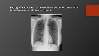 ● Radiografia ao tórax : os raios-X são importantes para avaliar
indiretamente os pulmões e o coração.
 