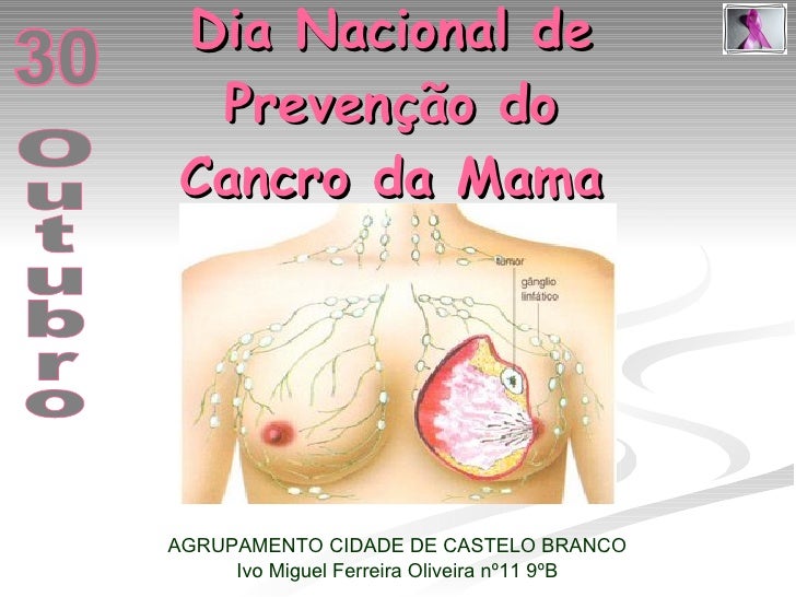 Dia Nacional de Prevenção do Cancro da Mama AGRUPAMENTO CIDADE DE CASTELO BRANCO Ivo Miguel Ferreira Oliveira nº11 9ºB Out...