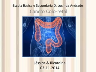 Escola Básica e Secundária D. Lucinda Andrade 
Cancro Colo-retal 
Jéssica & Ricardina 
03-11-2014 
 