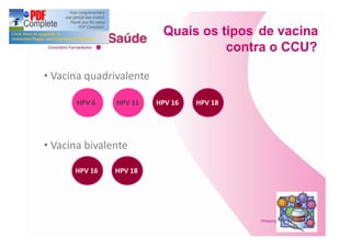 Quais os tipos de vacina
                                  contra o CCU?

Vacina quadrivalente

     HPV 6    HPV 11   HPV 16   HPV 18




Vacina bivalente

     HPV 16   HPV 18
 