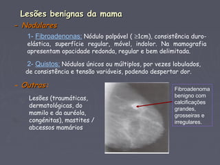 Lesões benignas da mamaLesões benignas da mama
-- NodularesNodulares
1- Fibroadenonas: Nódulo palpável ( ≥1cm), consistência duro-
elástica, superfície regular, móvel, indolor. Na mamografia
apresentam opacidade redonda, regular e bem delimitada.
2- Quistos: Nódulos únicos ou múltiplos, por vezes lobulados,
de consistência e tensão variáveis, podendo despertar dor.
- OutrasOutras:
Lesões (traumáticas,
dermatológicas, do
mamilo e da auréola,
congénitas), mastites /
abcessos mamários
Fibroadenoma
benigno com
calcificações
grandes,
grosseiras e
irregulares.
 