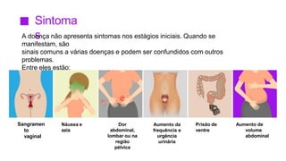 Sintoma
s
A doença não apresenta sintomas nos estágios iniciais. Quando se
manifestam, são
sinais comuns a várias doenças e podem ser confundidos com outros
problemas.
Entre eles estão:
Aumento da
frequência e
urgência
urinária
Sangramen
to
vaginal
Dor
abdominal,
lombar ou na
região
pélvica
Aumento de
volume
abdominal
Náusea e
azia
Prisão de
ventre
 