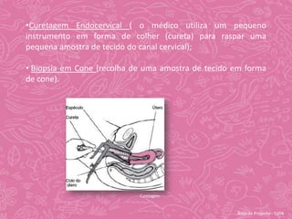  Administração excessiva do fármaco dietilestilbestrol (DES).Área de Projecto - 12ºA