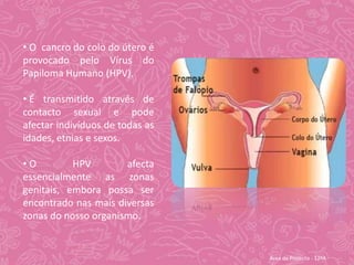  O  cancro do colo do útero é provocado pelo Vírus do Papiloma Humano (HPV).