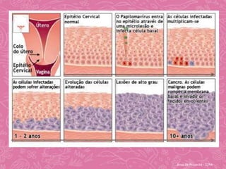 O HPV afecta essencialmente as zonas genitais, embora possa ser encontrado nas mais diversas zonas do nosso organismo.Área de Projecto - 12ºA