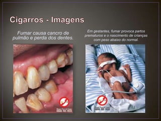 Cigarros - ImagensFumar causa cancro de pulmão e perda dos dentes.Em gestantes, fumar provoca partos prematuros e o nascimento de crianças com peso abaixo do normal.