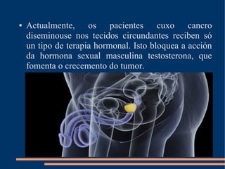 ● Actualmente, os pacientes cuxo cancro
diseminouse nos tecidos circundantes reciben só
un tipo de terapia hormonal. Isto bloquea a acción
da hormona sexual masculina testosterona, que
fomenta o crecemento do tumor.
 
