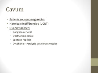 Cavum
• Patients souvent maghrébins
• Histologie indifférenciée (UCNT)
• Quand y penser?
• Ganglion cervical
• Obstruction nasale
• Epistaxis répétés
• Dysphonie - Paralysie des cordes vocales
 