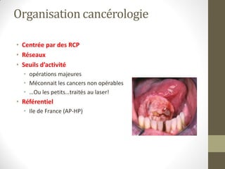 Organisation cancérologie
• Centrée par des RCP
• Réseaux
• Seuils d’activité
• opérations majeures
• Méconnait les cancers non opérables
• …Ou les petits…traités au laser!
• Référentiel
• Ile de France (AP-HP)
 