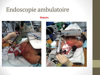 Endoscopie ambulatoire
Biopsies
 