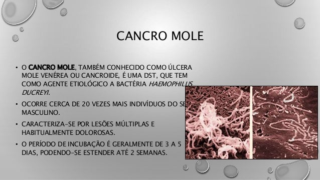 Cancro mole e hpv
