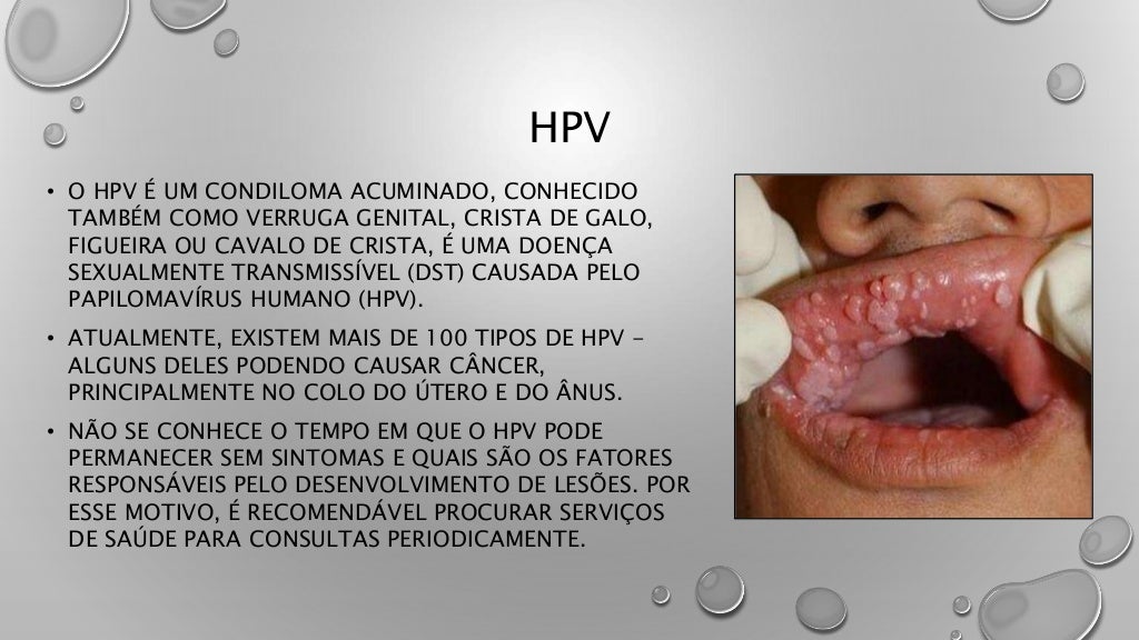 Cancro mole e hpv Cancro mole e hpv