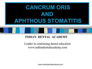 CANCRUM ORIS
AND
APHTHOUS STOMATITIS
INDIAN DENTAL ACADEMY
Leader in continuing dental education
www.indiandentalacademy.com
www.indiandentalacademy.com
 
