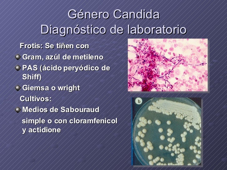 Urinary Tract Infection