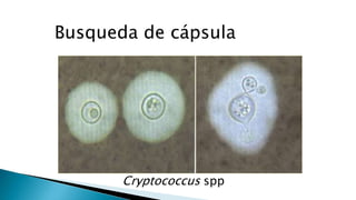 Busqueda de cápsula
Cryptococcus spp
 