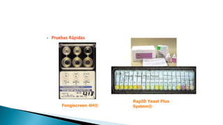  Pruebas Rápidas
RapID Yeast Plus
System®Fongiscreen 4H®
 