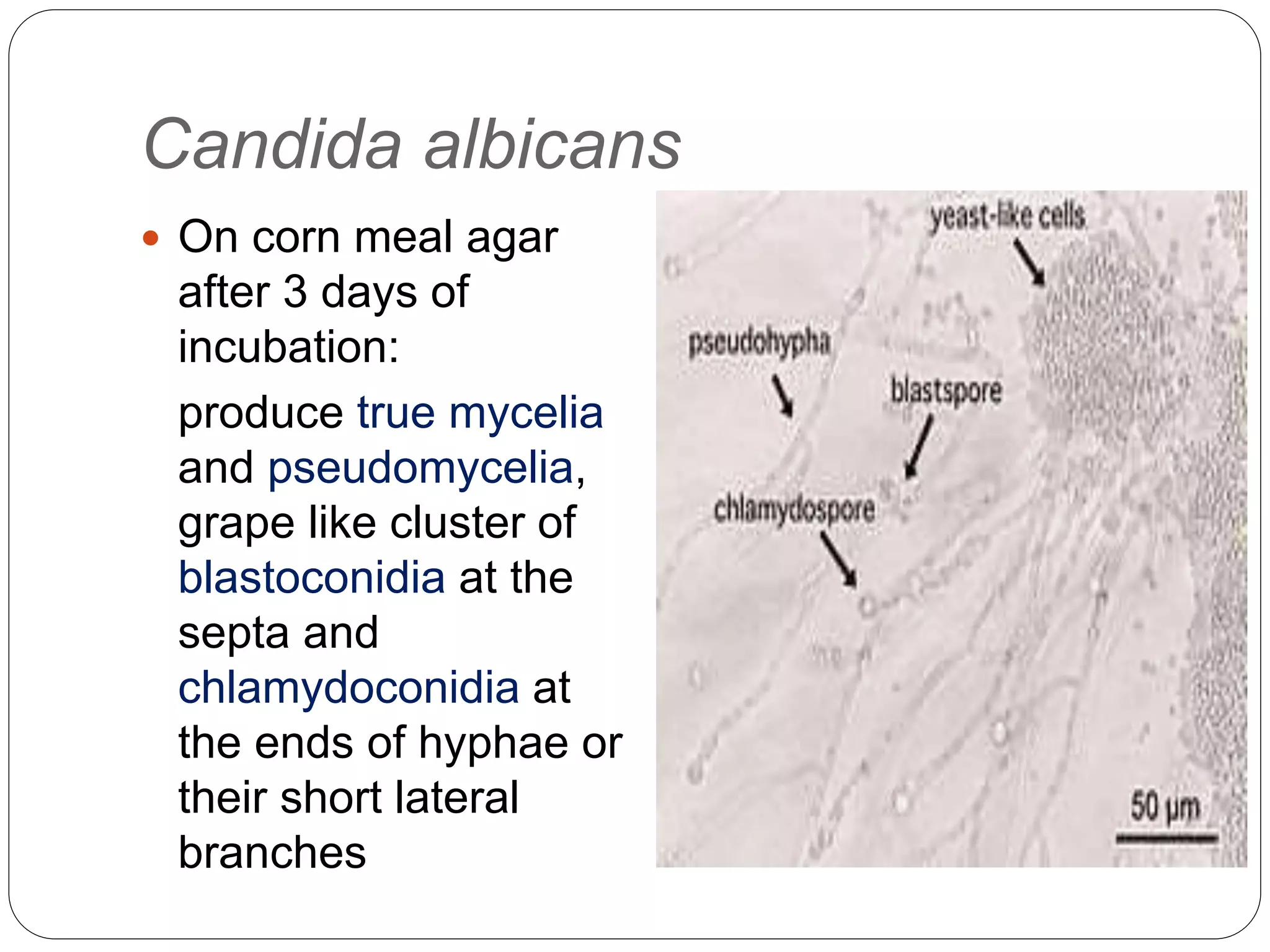 Candida | PPT