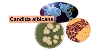 Candida albicans
 