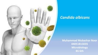 Candida albicans
Muhammad Mubashar Noor
04051813035
Microbiology
BS 6th
 