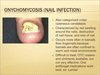 ONYCHOMYCOSIS (NAIL INFECTION)
 Also categorized under
cutaneous candidiasis
 Characterized by red swelling
around the nails, destruction
of nail tissue, and loss of nail
 Occurs more often in toenails
than fingernails because
toenails are often confined to
warm and moist environments
 Difficult to treat; OTC creams
and ointments available, but
not very effective; Oral
antifungal medications work
best, ex: Lamisil
 
