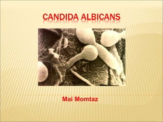 CANDIDA ALBICANS
Mai Momtaz
 