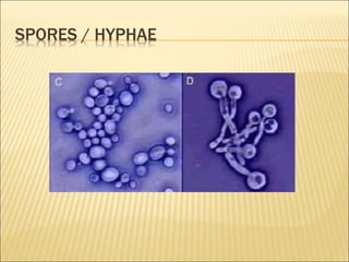 SPORES / HYPHAE
 