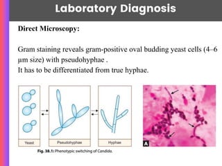 Laboratory Diagnosis
Direct Microscopy:
Gram staining reveals gram-positive oval budding yeast cells (4–6
µm size) with pseudohyphae .
It has to be differentiated from true hyphae.
 