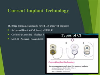 Current Implant Technology
The three companies currently have FDA approved implants:
 Advanced Bionics (California) - HR90 K
 Cochlear (Australia) - Nucleus 5
 Med-El (Austria) - Sonata ti100
 