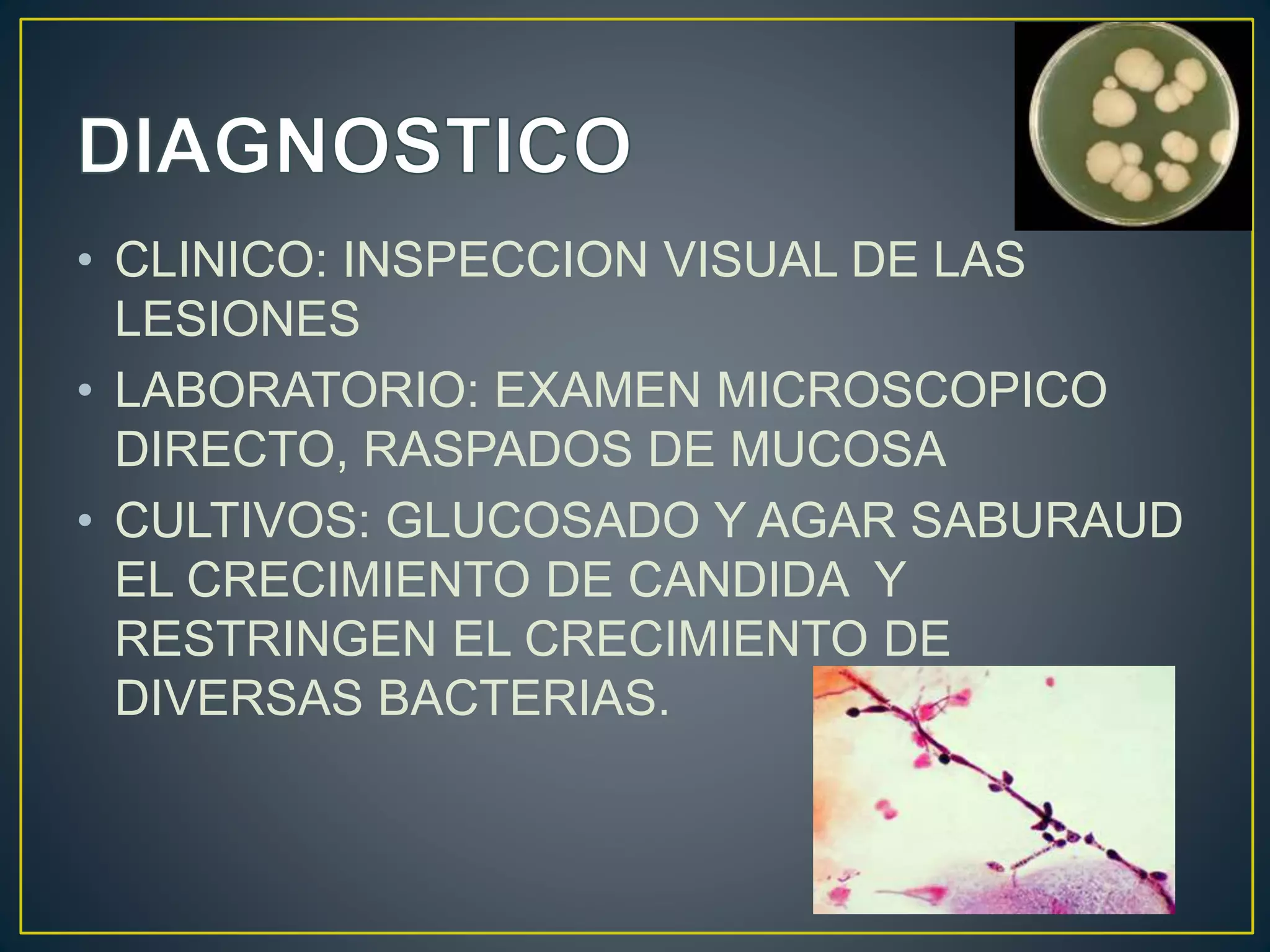 Candida o candidiasis | PPTX
