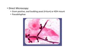 Direct Microscopy Candida pathogen.pptx