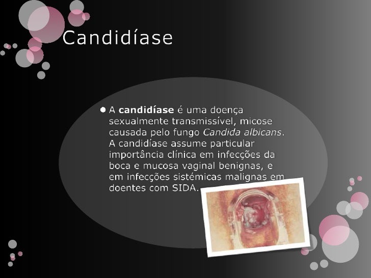candidase-3-728.jpg?cb=1275419919