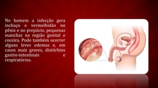 No homem a infecção gera
inchaço e vermelhidão no
pênis e no prepúcio, pequenas
manchas na região genital e
coceira. Pode também ocorrer
alguns leves edemas e, em
casos mais graves, distúrbios
gastro-intestinais e
respiratórios.
 