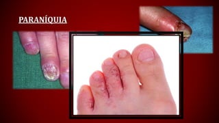 PARANÍQUIA
 