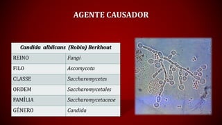 AGENTE CAUSADOR
Candida albilcans (Robin) Berkhout
REINO Fungi
FILO Ascomycota
CLASSE Saccharomycetes
ORDEM Saccharomycetales
FAMÍLIA Saccharomycetaceae
GÉNERO Candida
 