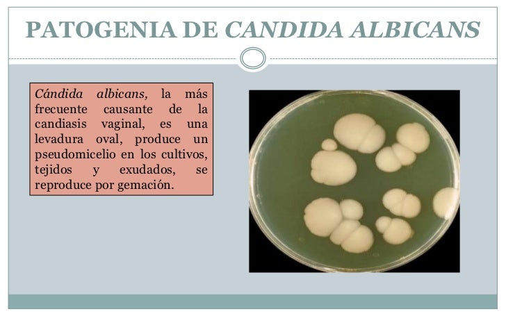 candidiasis-5-728.jpg?cb=1311256292