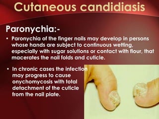 Cutaneous candidiasis
Paronychia:-
• Paronychia of the finger nails may develop in persons
  whose hands are subject to continuous wetting,
  especially with sugar solutions or contact with flour, that
  macerates the nail folds and cuticle.

• In chronic cases the infection
  may progress to cause
  onychomycosis with total
  detachment of the cuticle
  from the nail plate.
 