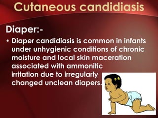 Cutaneous candidiasis
Diaper:-
• Diaper candidiasis is common in infants
  under unhygienic conditions of chronic
  moisture and local skin maceration
  associated with ammonitic
  irritation due to irregularly
  changed unclean diapers.
 