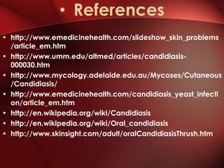 • References
• http://www.emedicinehealth.com/slideshow_skin_problems
  /article_em.htm
• http://www.umm.edu/altmed/articles/candidiasis-
  000030.htm
• http://www.mycology.adelaide.edu.au/Mycoses/Cutaneous
  /Candidiasis/
• http://www.emedicinehealth.com/candidiasis_yeast_infecti
  on/article_em.htm
• http://en.wikipedia.org/wiki/Candidiasis
• http://en.wikipedia.org/wiki/Oral_candidiasis
• http://www.skinsight.com/adult/oralCandidiasisThrush.htm
 