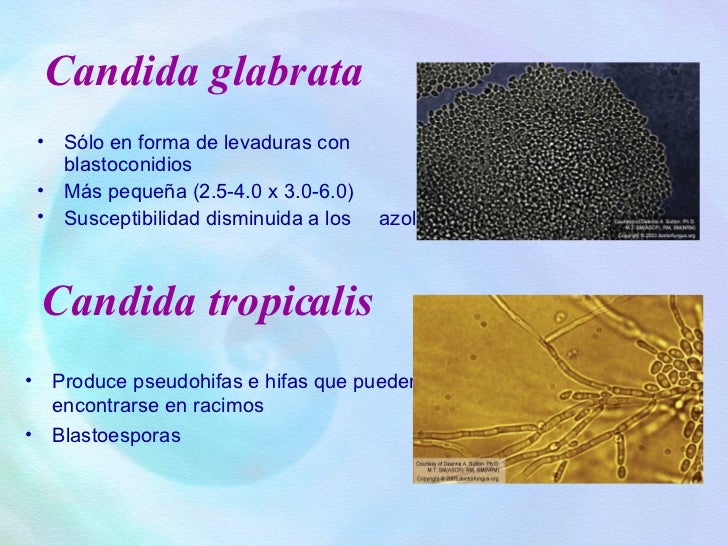 Candida Genitali Bimbo Urethritis Cause Can - Yourbuzz Mission