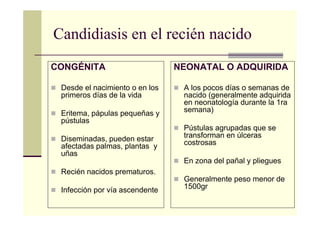 Candidiasis en el recién nacido
CONGÉNITA
Desde el nacimiento o en los
primeros días de la vida
Eritema, pápulas pequeñas y
pústulas
Diseminadas, pueden estar
afectadas palmas, plantas y
uñas
Recién nacidos prematuros.
Infección por vía ascendente
NEONATAL O ADQUIRIDA
A los pocos días o semanas de
nacido (generalmente adquirida
en neonatología durante la 1ra
semana)
Pústulas agrupadas que se
transforman en úlceras
costrosas
En zona del pañal y pliegues
Generalmente peso menor de
1500gr
 