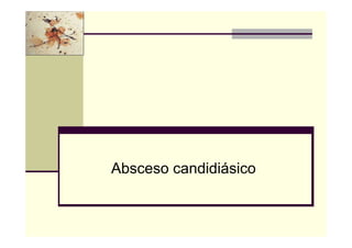 Absceso candidiásico
 