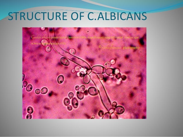 candidiasis